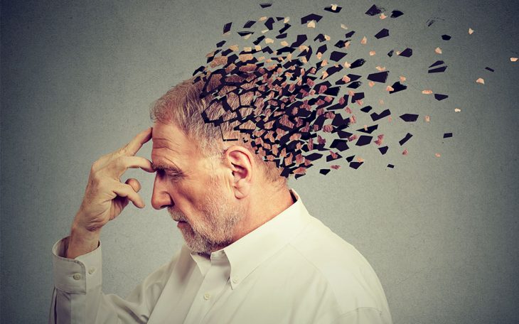 بیماری آلزایمر